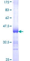ADH4 Protein - 12.5% SDS-PAGE Stained with Coomassie Blue.