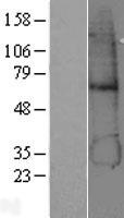 ADH5 Protein - Western validation with an anti-DDK antibody * L: Control HEK293 lysate R: Over-expression lysate