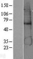 ADH5 Protein - Western validation with an anti-DDK antibody * L: Control HEK293 lysate R: Over-expression lysate