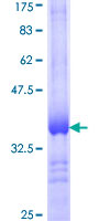 ADH5 Protein - 12.5% SDS-PAGE Stained with Coomassie Blue.