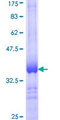 ADH5 Protein - 12.5% SDS-PAGE Stained with Coomassie Blue.