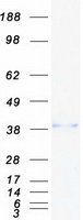 ADH5 Protein - Purified recombinant protein ADH5 was analyzed by SDS-PAGE gel and Coomassie Blue Staining
