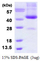 ADH6 Protein
