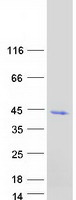 ADH6 Protein - Purified recombinant protein ADH6 was analyzed by SDS-PAGE gel and Coomassie Blue Staining