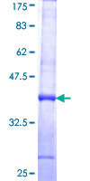 ADH7 Protein - 12.5% SDS-PAGE Stained with Coomassie Blue.