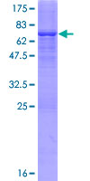 ADHFE1 Protein - 12.5% SDS-PAGE of human ADHFE1 stained with Coomassie Blue