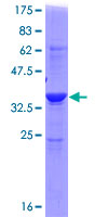 ADI1 / ARD Protein - 12.5% SDS-PAGE of human ADI1 stained with Coomassie Blue