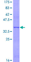 Adiponectin Protein - 12.5% SDS-PAGE Stained with Coomassie Blue.