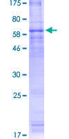ADIPOR1/Adiponectin Receptor 1 Protein - 12.5% SDS-PAGE of human ADIPOR1 stained with Coomassie Blue