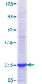 ADIPOR1/Adiponectin Receptor 1 Protein - 12.5% SDS-PAGE Stained with Coomassie Blue.