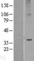 ADIPOR2 Protein - Western validation with an anti-DDK antibody * L: Control HEK293 lysate R: Over-expression lysate