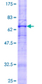 ADIPOR2 Protein - 12.5% SDS-PAGE of human ADIPOR2 stained with Coomassie Blue