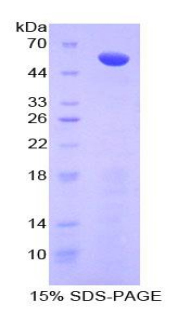 ADIPOR2 Protein - Recombinant Adiponectin Receptor 2 By SDS-PAGE