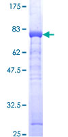 ADK / Adenosine Kinase Protein - 12.5% SDS-PAGE of human ADK stained with Coomassie Blue
