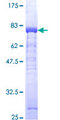 ADK / Adenosine Kinase Protein - 12.5% SDS-PAGE of human ADK stained with Coomassie Blue