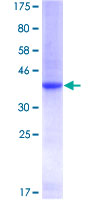 ADK / Adenosine Kinase Protein - 12.5% SDS-PAGE Stained with Coomassie Blue.