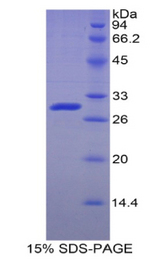 ADK / Adenosine Kinase Protein - Recombinant Adenosine Kinase By SDS-PAGE