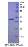 ADK / Adenosine Kinase Protein - Recombinant Adenosine Kinase By SDS-PAGE