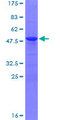 ADM / Adrenomedullin Protein - 12.5% SDS-PAGE of human ADM stained with Coomassie Blue
