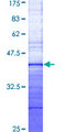 ADM / Adrenomedullin Protein - 12.5% SDS-PAGE Stained with Coomassie Blue.
