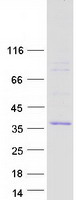 ADM / Adrenomedullin Protein - Purified recombinant protein ADM was analyzed by SDS-PAGE gel and Coomassie Blue Staining