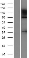 ADNP2 Protein - Western validation with an anti-DDK antibody * L: Control HEK293 lysate R: Over-expression lysate