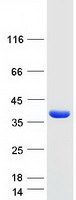 ADO Protein - Purified recombinant protein ADO was analyzed by SDS-PAGE gel and Coomassie Blue Staining