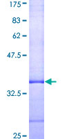 ADORA3 / Adenosine A3 Receptor Protein - 12.5% SDS-PAGE Stained with Coomassie Blue.