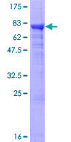 ADPGK Protein - 12.5% SDS-PAGE of human ADPGK stained with Coomassie Blue