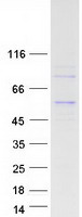 ADPGK Protein - Purified recombinant protein ADPGK was analyzed by SDS-PAGE gel and Coomassie Blue Staining