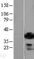 ADPRH / ARH1 Protein - Western validation with an anti-DDK antibody * L: Control HEK293 lysate R: Over-expression lysate