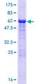 ADPRH / ARH1 Protein - 12.5% SDS-PAGE of human ADPRH stained with Coomassie Blue