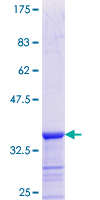 ADPRH / ARH1 Protein - 12.5% SDS-PAGE Stained with Coomassie Blue.