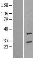 ADPRHL1 Protein - Western validation with an anti-DDK antibody * L: Control HEK293 lysate R: Over-expression lysate