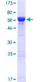 ADPRHL1 Protein - 12.5% SDS-PAGE of human ADPRHL1 stained with Coomassie Blue