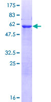 ADPRHL2 Protein - 12.5% SDS-PAGE of human ADPRHL2 stained with Coomassie Blue