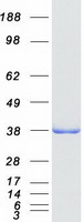 ADPRHL2 Protein - Purified recombinant protein ADPRHL2 was analyzed by SDS-PAGE gel and Coomassie Blue Staining