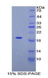 ADRA1A Protein - Recombinant Adrenergic Receptor Alpha 1A By SDS-PAGE