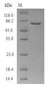 ADRB2 Protein - (Tris-Glycine gel) Discontinuous SDS-PAGE (reduced) with 5% enrichment gel and 15% separation gel.