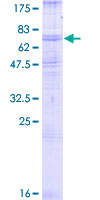 ADRB2 Protein - 12.5% SDS-PAGE of human ADRB2 stained with Coomassie Blue