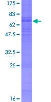 ADRB3 Protein - 12.5% SDS-PAGE of human ADRB3 stained with Coomassie Blue