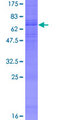 ADRB3 Protein - 12.5% SDS-PAGE of human ADRB3 stained with Coomassie Blue