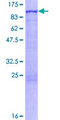 ADRBK1 / GRK2 Protein - 12.5% SDS-PAGE of human ADRBK1 stained with Coomassie Blue