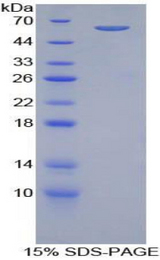 ADRBK1 / GRK2 Protein - Recombinant Adrenergic Receptor Beta Kinase 1 By SDS-PAGE