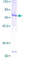 ADRBK2 / GRK3 Protein - 12.5% SDS-PAGE of human ADRBK2 stained with Coomassie Blue
