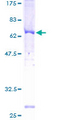 ADRBK2 / GRK3 Protein - 12.5% SDS-PAGE of human ADRBK2 stained with Coomassie Blue
