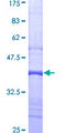 ADRBK2 / GRK3 Protein - 12.5% SDS-PAGE Stained with Coomassie Blue.
