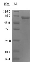 ADRM1 Protein - (Tris-Glycine gel) Discontinuous SDS-PAGE (reduced) with 5% enrichment gel and 15% separation gel.