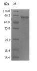 ADRM1 Protein - (Tris-Glycine gel) Discontinuous SDS-PAGE (reduced) with 5% enrichment gel and 15% separation gel.