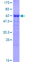ADRM1 Protein - 12.5% SDS-PAGE of human ADRM1 stained with Coomassie Blue